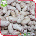 Pulses / Light Speckled Kidney Beans / Dried Beans